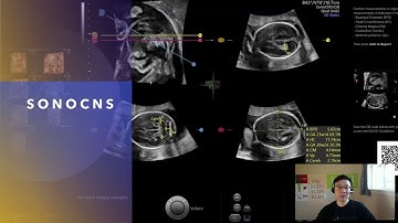 Accelerated graphics and compute API for Machine Learning - DirectML