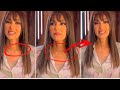 حنان مطاوع بعد عملية استئصال الغدة الدرقية ورسالتها للجمهور انا اسفة ليكم وتظهر مكان وشكل العملية