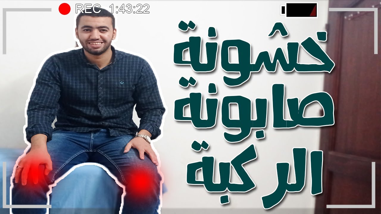 تخلص من ألم خشونة صابونة الركبة │ خشونة الركبة الكاذبة │ خشونة الرضفة