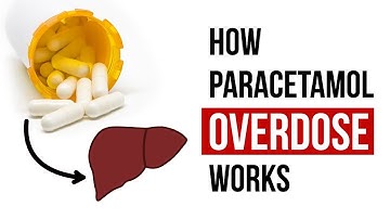 How Tylenol Overdose Works