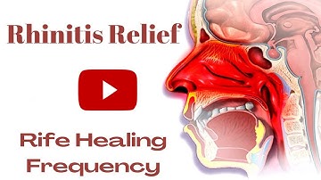 Rhinitis Relief - Rife Healing Frequency | Isochronic Binaural Beats | Rhinitis Rife Treatment Ⅰ