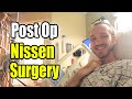 In Hospital After Nissen Fundoplication Surgery (Whats Recovery like?)