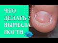 Комбинированный маникюр. Как восстановить вырванные ногти.