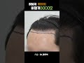 617번 비절개 3000모 남자