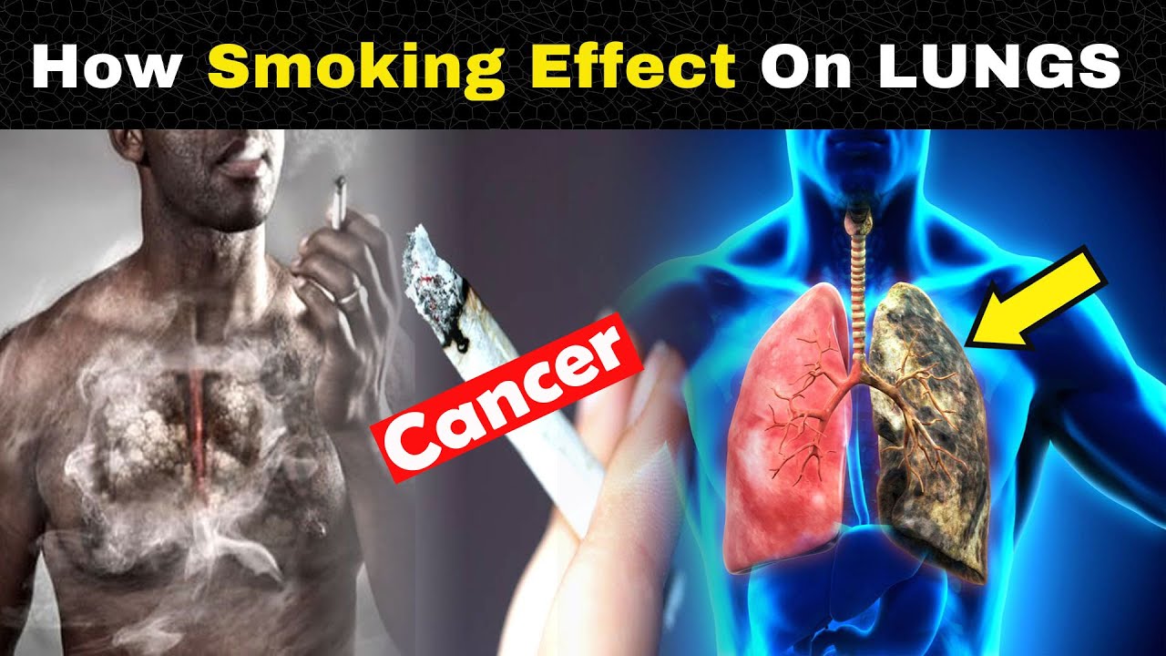 How Smoking Effect on LUNGS and Human Body ? YouTube