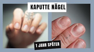 Kaputte Nägel... |  Das hilft!