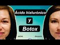 BOTOX VS ÁCIDO HIALURÓNICO 💚💙💜 ADIOS ARRUGAS 💋 DR. ALBERTO CALVO - MEDICINA EXTRAORDINARIA