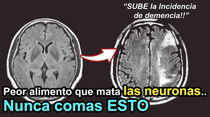 Te recomiendo ver ESTO si necesitas cuidar la salud cerebral y la memoria....