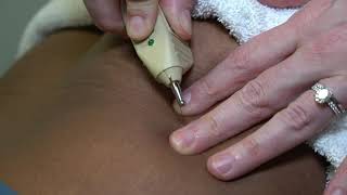 Acupuncture with Electrical Stimulation at Back & Body Medical Midtown Manhattan
