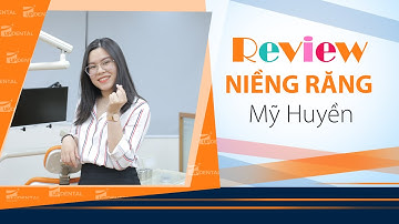 [Review niềng răng]: #166 Kết quả niềng răng của Mỹ Huyền