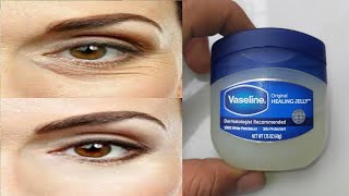 How to remove wrinkles under eyes naturally with Vaseline | Bags under the eyes, Reduce wrinkles
