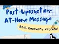 🎥 Post-Liposuction Care 101: Why Massage Matters 👐✨ | #drdevayanibarve