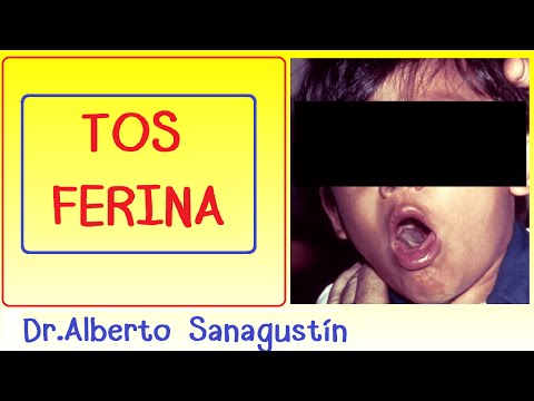 Video: ¿Cuánto dura la tos ferina?