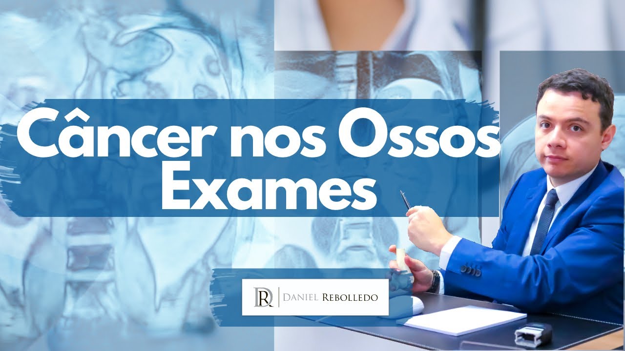 Câncer nos ossos Quais exames detectam?/ Qual exame diagnostica câncer nos ossos? (2020) YouTube Câncer nos ossos Quais exames detectam?/ Qual exame diagnostica câncer nos ossos? (2020) YouTube