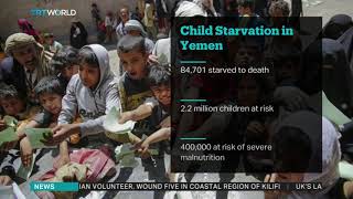 Child Starvation In Yemen