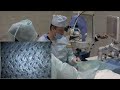 Операция СLEAR живая хирургия. live surgery. New Lenticule application by Ziemer