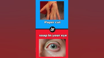 Would You Rather Part 23 #quiz #wouldyourathergame #shorts #viralshorts