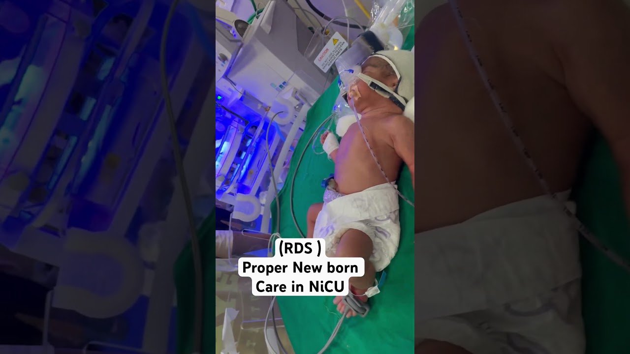 What is RDS…respiratory distress syndrome..proper medical care in NICU 