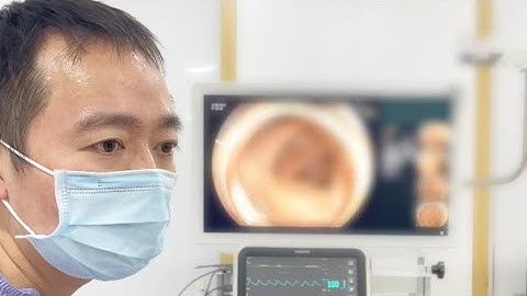 Nội soi phát hiện UNG THƯ dạ dày và đại tràng.