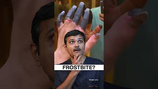 Vascular Surgeon Reacts to "DEAD Fingers" #shortsviral #frostbite #drsumitkapadia