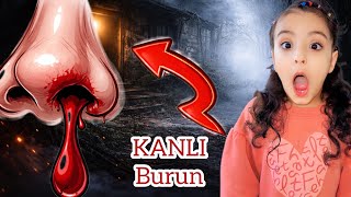 O Kızı Burun Neden O Kadar Kocamanmış?