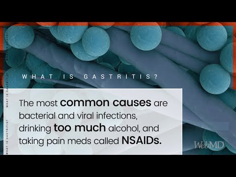 Viagra generico doc on line