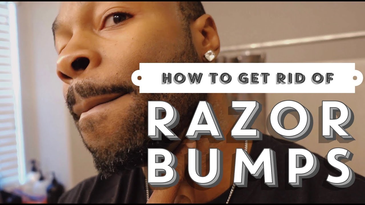 How to get rid of razor bumps| How to get rid of razor burn| How to clear  up razor bumps video - thptnganamst.edu.vn