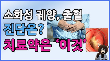 소화성 궤양, 출혈 진단과 치료에 대해 알려드립니다