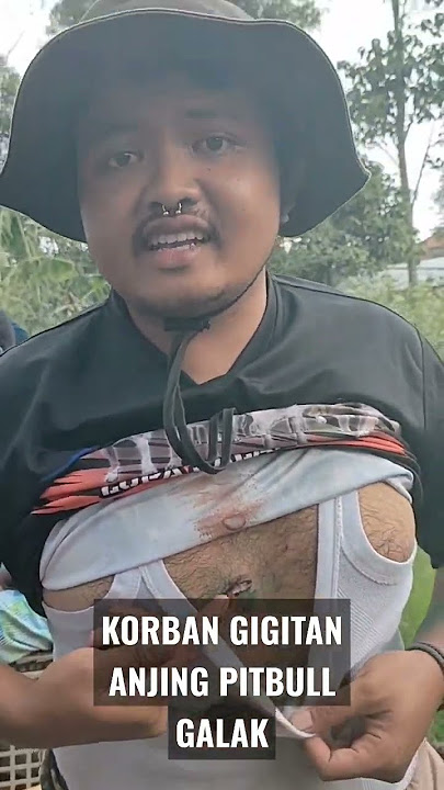 VICTIM OF FIERCE PITBULL DOG ​​BITE