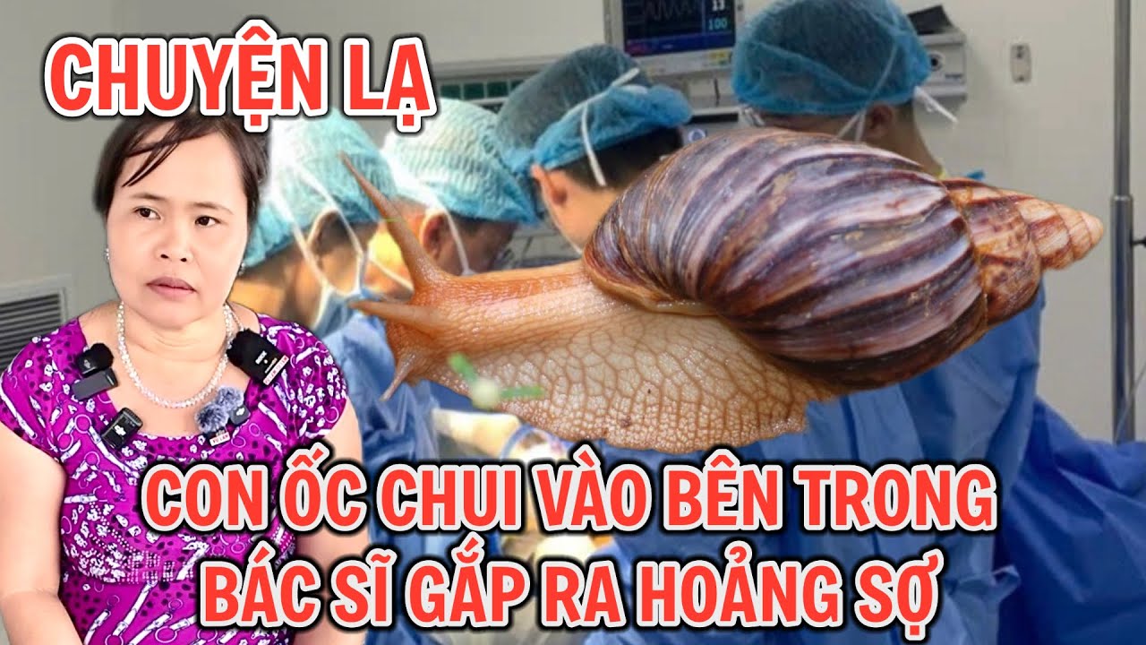 Chuyện lạ khó tin con ốc phương chui vào bên trong khiến phải nhập viện gắp 0945101203 TÀI UMT