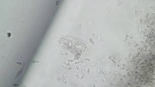Chilomonas