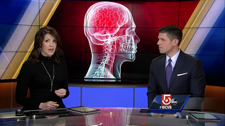 BU study: Impacts, not just concussions, linked to...