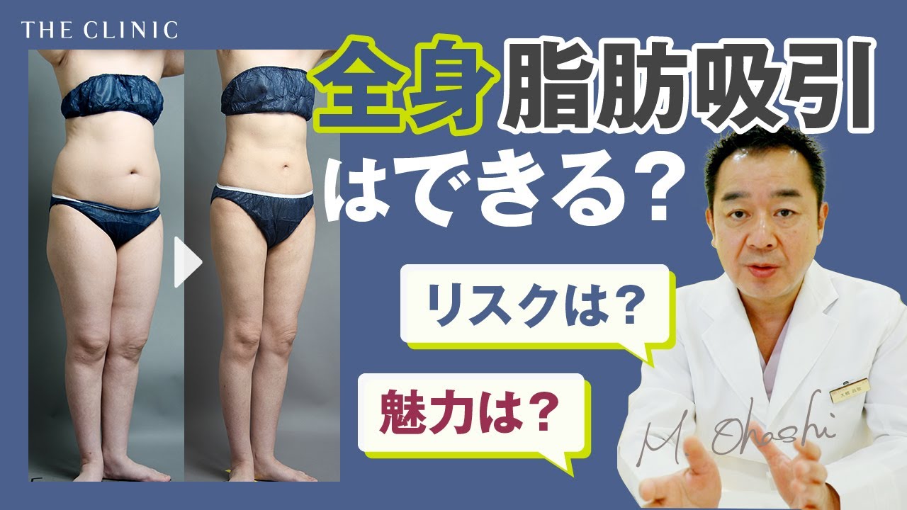 全身の脂肪吸引Q&A｜医師が教える脂肪吸引安心ガイド