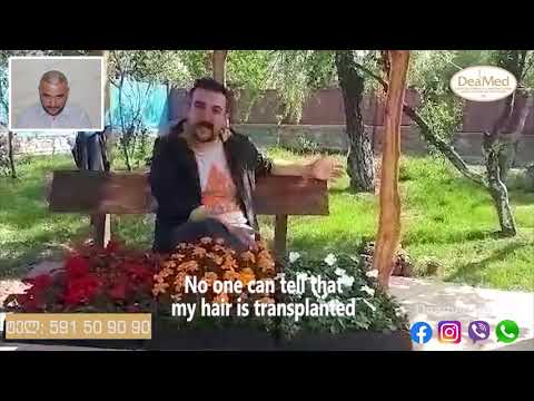 ნიკა წულუკიძე - თმის გადანერგვა FUE მეთოდით