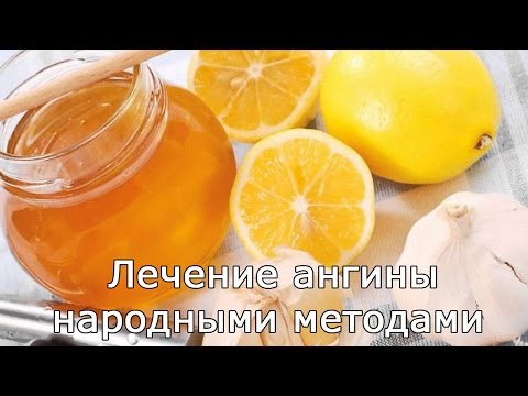 Лечение ангины народными методами