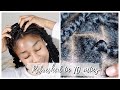 How To Clean Scalp With Braids Without Washing | Week 2 of Passion Twists Update!