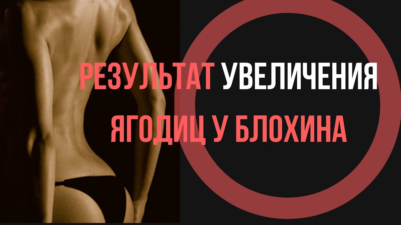 Увеличение ягодиц имплантами через микро-разрез - YouTube