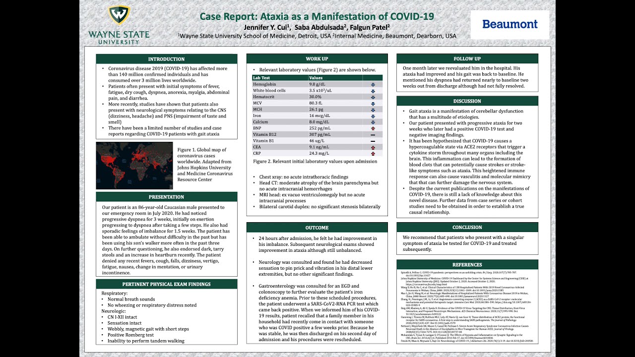 Case Report Ataxia as a Manifestation of COVID19 ACP Poster