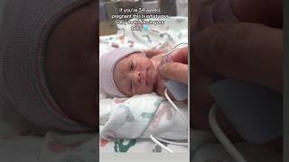 34 weeks baby #viral #baby #medicosstuff #trending #medical #millionviews #viralvideo #mbbs #love
