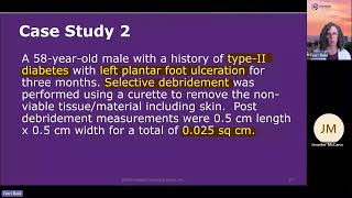 HCGTV: Webinar Snippet - Coding Diabetes with an Ulceration Case Study