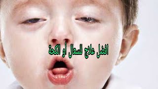 علاج الكحة  أو السعال عند الأطفال  والتخلص منه نهائيا