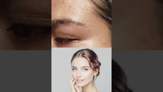 चेहरे पर हल्दी लगाने से पहले ये वीडियो जरूर देखो 😳#glowingskin #skincare #beautytips #shortvideos
