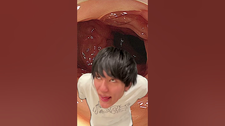 ISSEI funny video 😂😂😂 New Comedy Remix #shorts