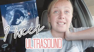 7 Weeks Pregnant and Ultrasound after 2 Miscarriages