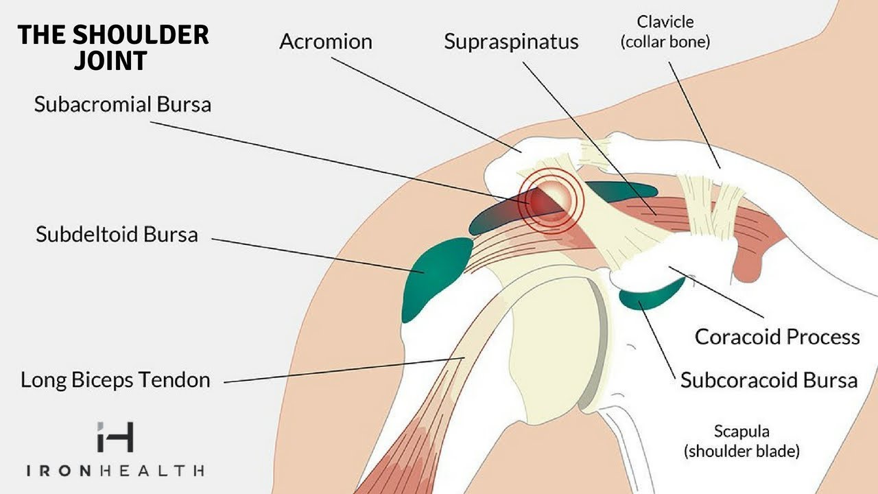 Clicking, Grinding, or Snapping Shoulder? Iron Health YouTube