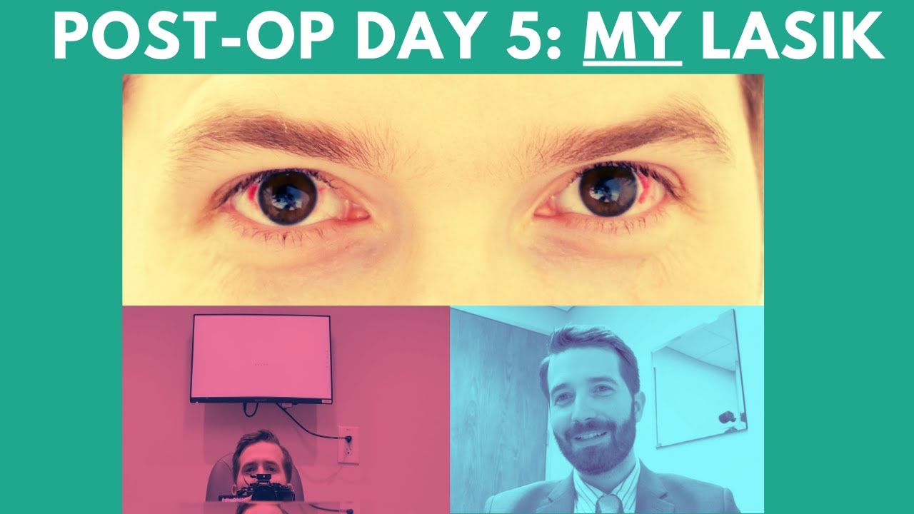 5 Days after LASIK: Eye Doctor's LASIK Experience