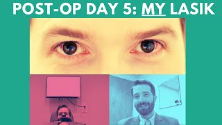 5 Days after LASIK: Eye Doctor's LASIK Experience