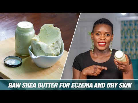 RAW SHEA BUTTER FOR ECZEMA And Dry Skin|BEST Solution For My Kid&rsquo;s Eczema