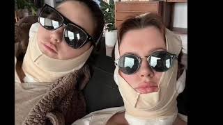 Ireland Baldwin, 26, recovers after trip to the plastic surgeon for new 'mini facelift' procedure