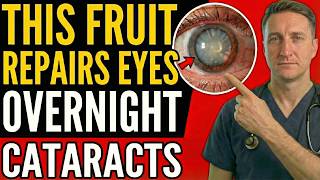 Dokter legt uit: Het beste fruit om voor het slapengaan te eten voor gezonde ogen